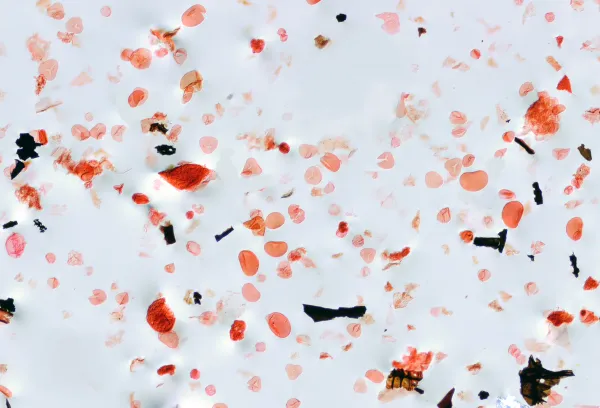 Dozens of grains of fossil pollen, of many different shapes, on a slide, magnified.